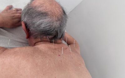 Acupuntura y el arte de mantener el Qi en la vejez